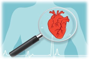 Protocolo de manejo de los factores de riesgo cardiovascular en el anciano